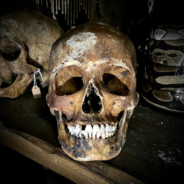 Human skull with mandible