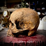 Human skull