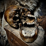 Human skull with mandible