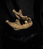 A mandible
