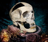 Medically prepared human skull