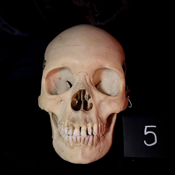 Item 5. Human medical skull