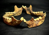 Item 10. Two human mandibles