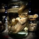Fetal specimen