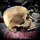 Human skull