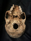 A human skull