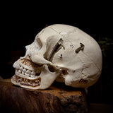 Medically prepared human skull
