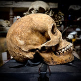 Human skull with mandible