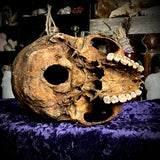 Human skull