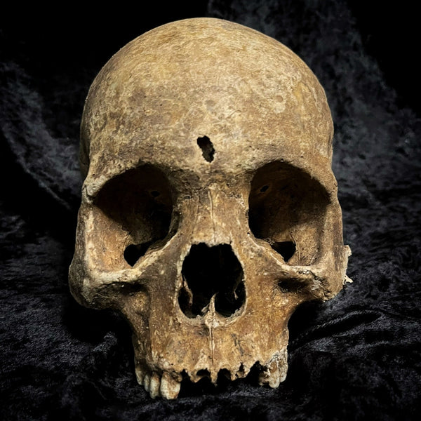 Human skull