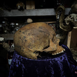 Human skull