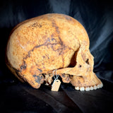 Item 15. Human skull