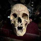 Human skull with mandible