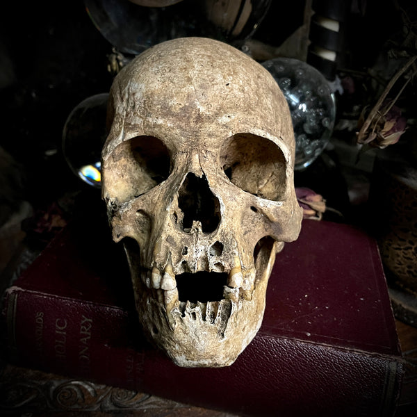Human skull with mandible