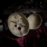 Adam Rouilly medical skull
