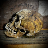 Human skull with mandible