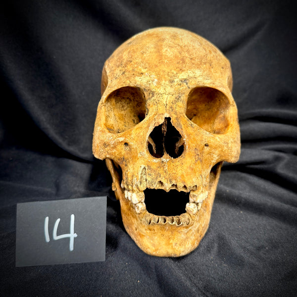 Item 14. Human skull with mandible