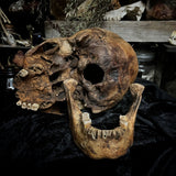 Human skull