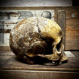 Human skull