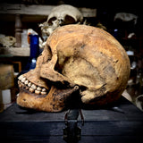 Human skull with mandible