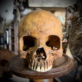Human skull