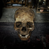 Human skull