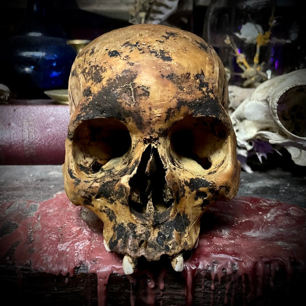 Human skull