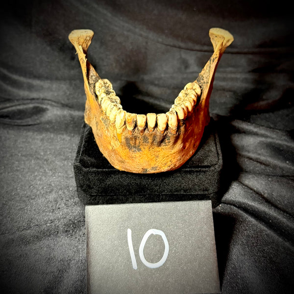 Item 10. Mandible