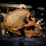 Human skull with mandible