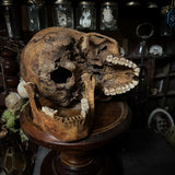 Human skull