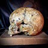 Item 3. Child skull