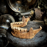 A mandible