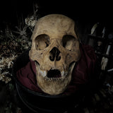 Human skull