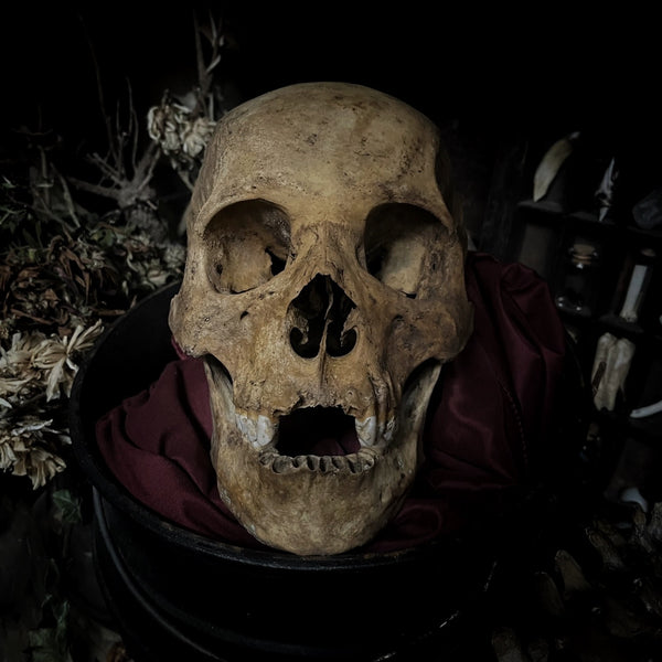 Human skull