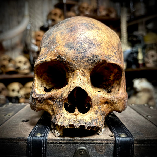 Human skull