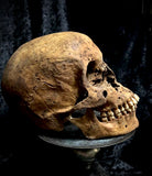 A human skull with mandible