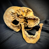 Item 1. Human skull with mandible