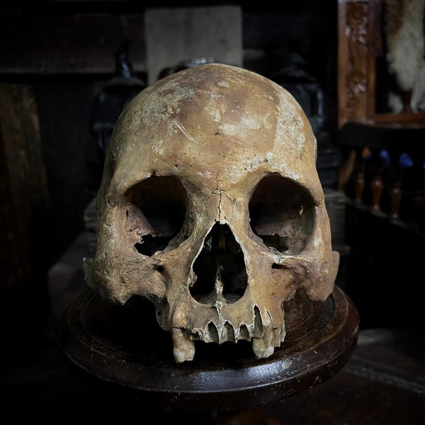 Human skull