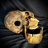 Item 1. Human skull with mandible