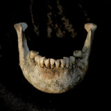 A mandible