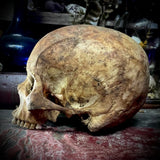 Human skull