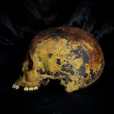 Item 1. Human skull