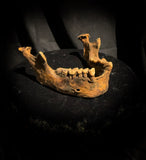 A mandible