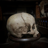 Human child skull