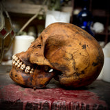 Human skull with mandible