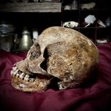 Human skull with mandible