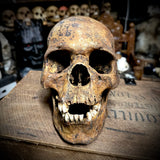 Human skull with mandible