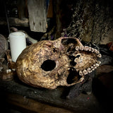 A human skull