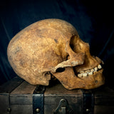 Item 11. Human skull with mandible