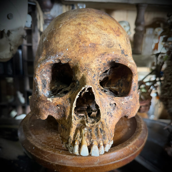 Human skull